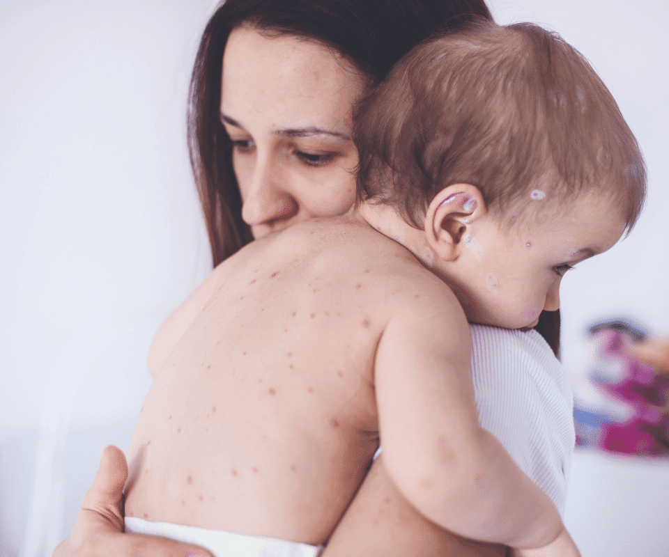 Explorând Bolile Copilăriei: De la Varicelă la Rubeolă