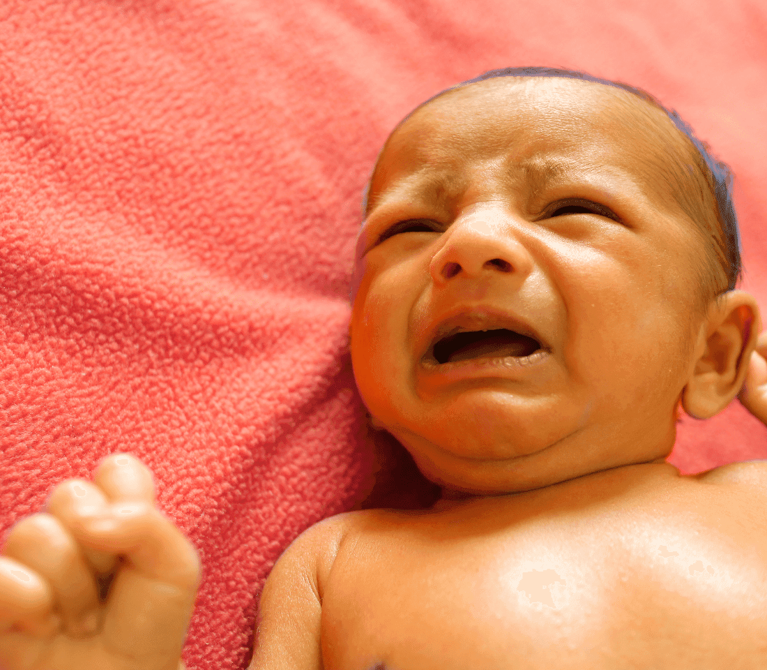 Icterul la Nou-Născuți: Cauze și Motive