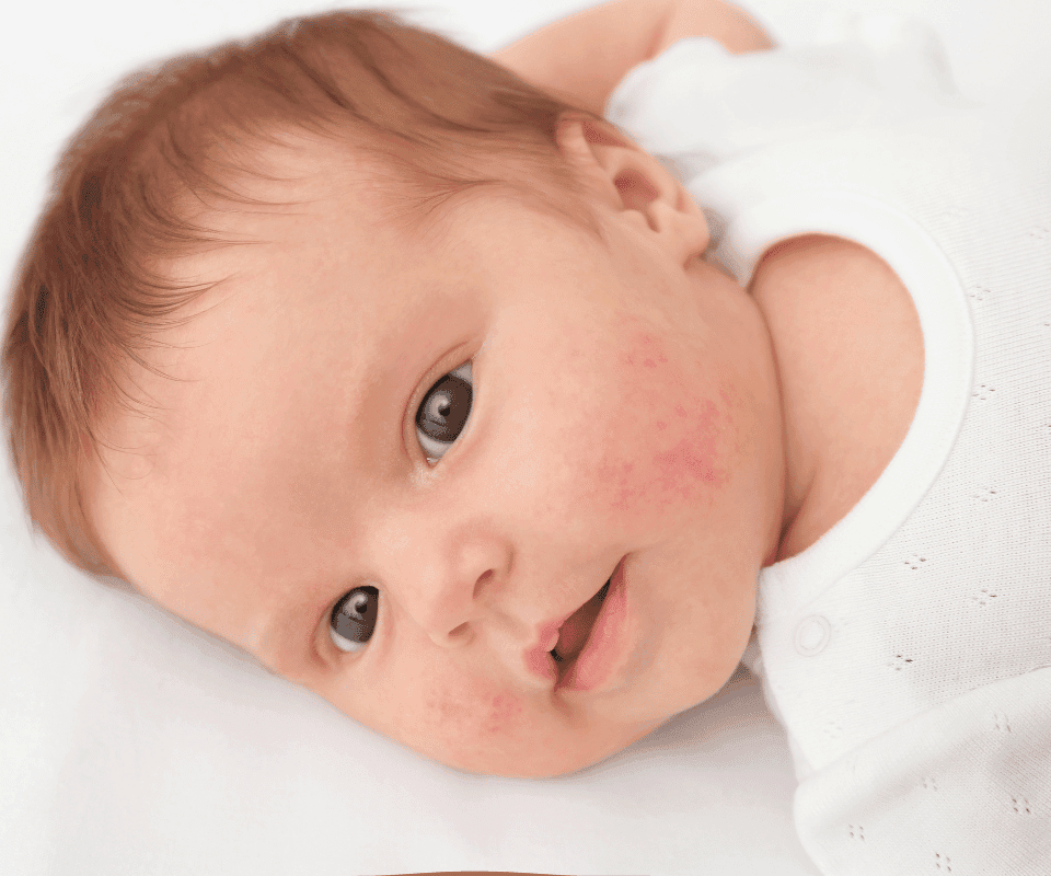 Reacțiile Adverse ale Bebelușilor la Anumite Alimente: Între Precauție și Intervenție Medicală